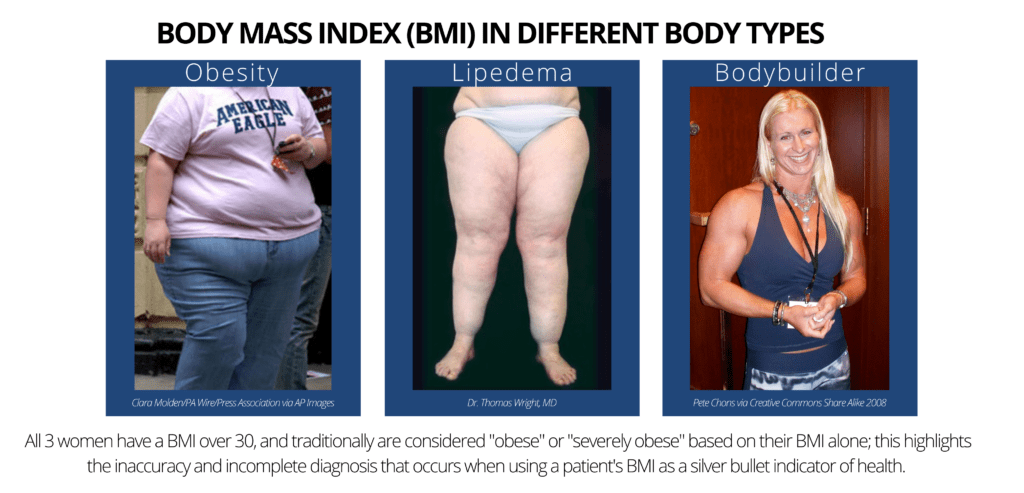 BMI-Body-Types